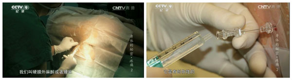 中国导乐集团纪录片:带你走进分娩疼痛的秘密